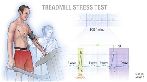 stress test hard to breathe|heart stress test not working.